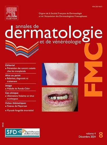 Annales de dermatologie<br/>et de vénérologie<br/>(version rouge)